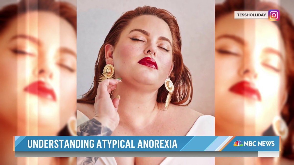 A social media influencer is sharing her story on her battle with atypical anorexia, hoping to help others understand that the eating disorder can affect people of all sizes.