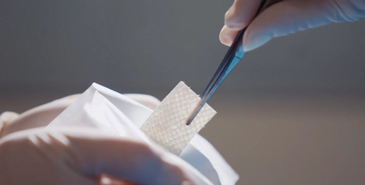 Kerecis is pioneering the use of fish skin and fatty-acids in the globally expanding cellular therapy and regenerative medicine market 🐟🩺 #Kerecis #fishskin #wound #burn #surgical