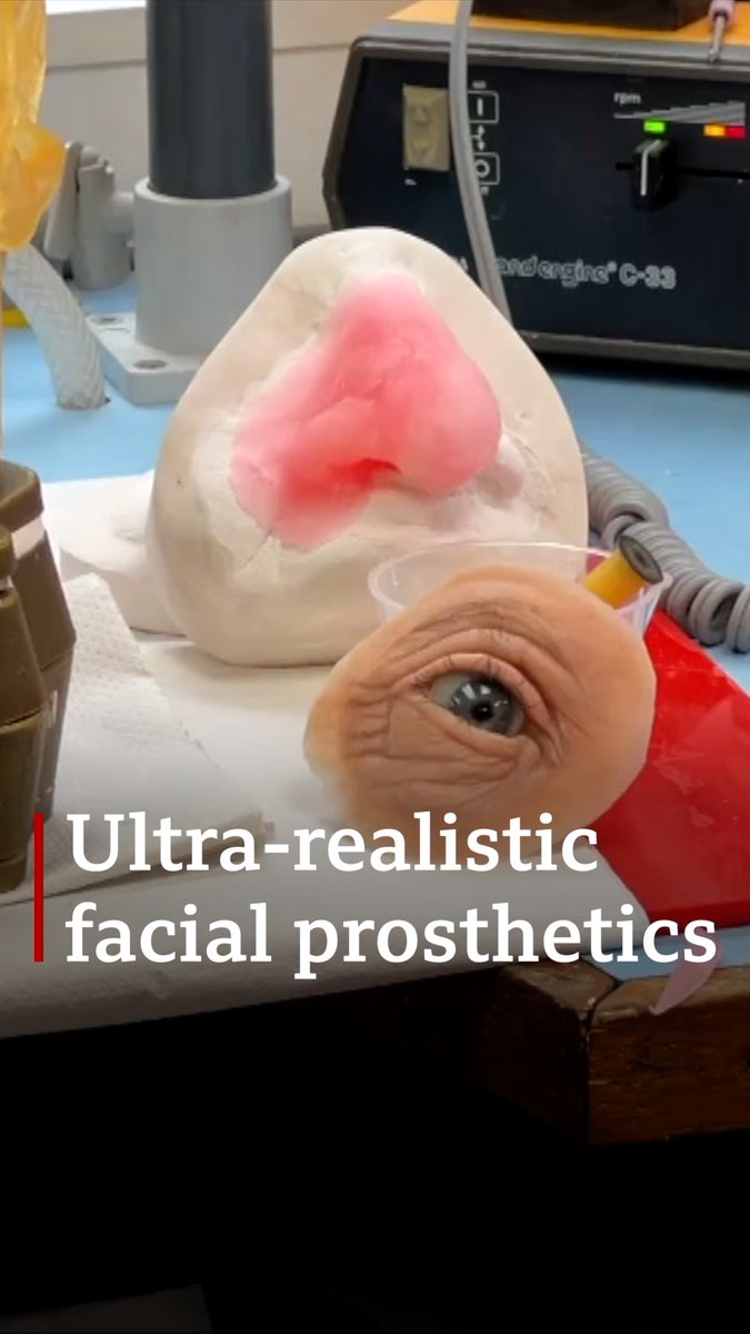 Patients fitted with ultra-realistic facial prosthetics have been speaking about their life-changing impact.