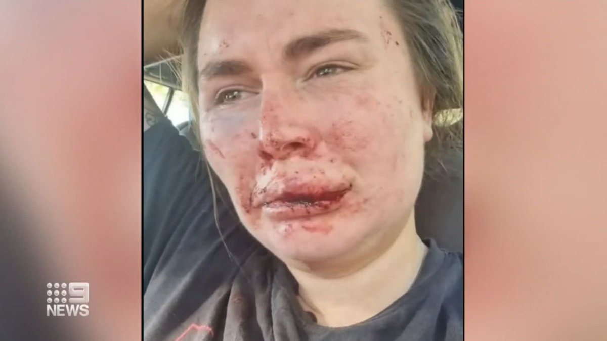 A Ballarat woman has suffered horrific injuries in a terrifying ambush. Indigenous activist Sissy Austin was assaulted by a man while jogging through the Lal Lal State Forest. Shuba Krishnan #9News