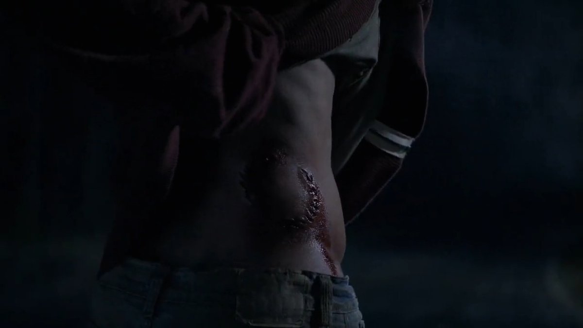 Psst, hey you! Let's recap the iconic first season of #TeenWolf together! Remember, you can rewatch all 6 seasons on @ParamountPlus 🐺
