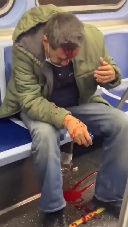 Dude gets left leaking after getting robbed and attacked by Subway Bandits...