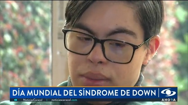 Día Mundial del Síndrome de Down, una fecha que busca crear conciencia sobre la inclusión. Más en