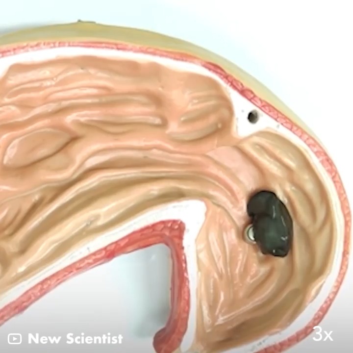 This poop-looking robot could one day perform tasks inside the human body. The robot is made of magnetic slime that can be controlled by external magnets to move, rotate, and form shapes. #gigadgets #medical #robootics #slime #research
