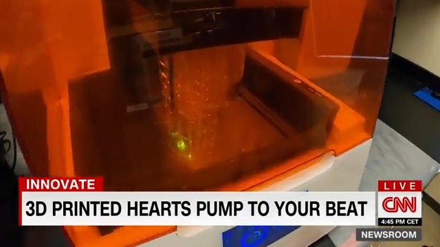 See how 3D printed hearts are being used to identify treatment options