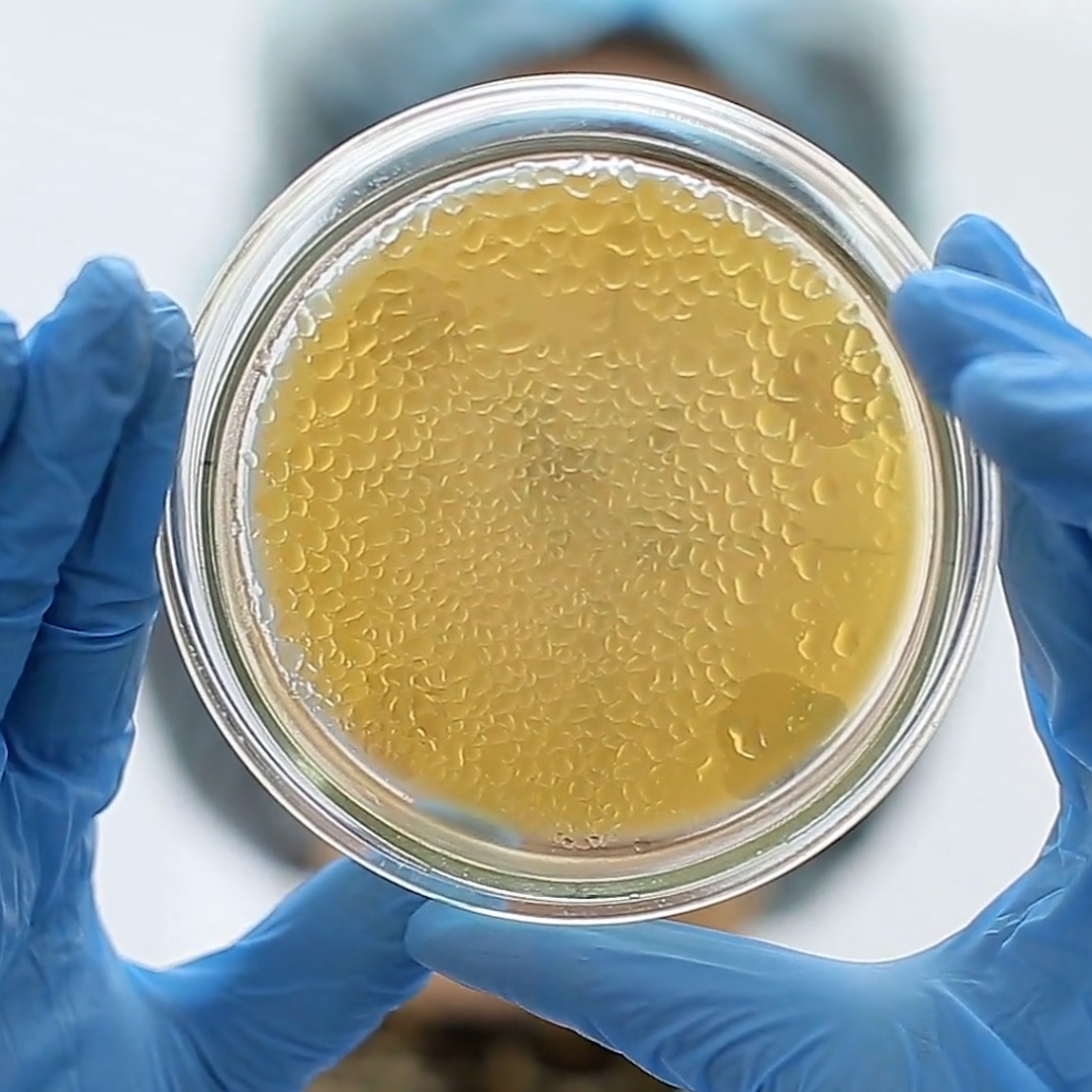 Most fungi can’t grow and reproduce in the human body because it’s too warm. But experts say they’re evolving—and a fungus called Candida auris is spreading rapidly in hospitals.