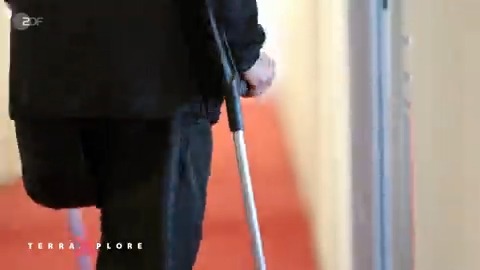 Lino hat sich sein gesundes Bein amputieren lassen. Er hat eine "Body Integrity Dysphoria" und will so endlich sein Körperbild mit seinem Körpergefühl übereinbringen. Damit ist er nicht allein – weltweit sind Tausende betroffen. #TerraXplore