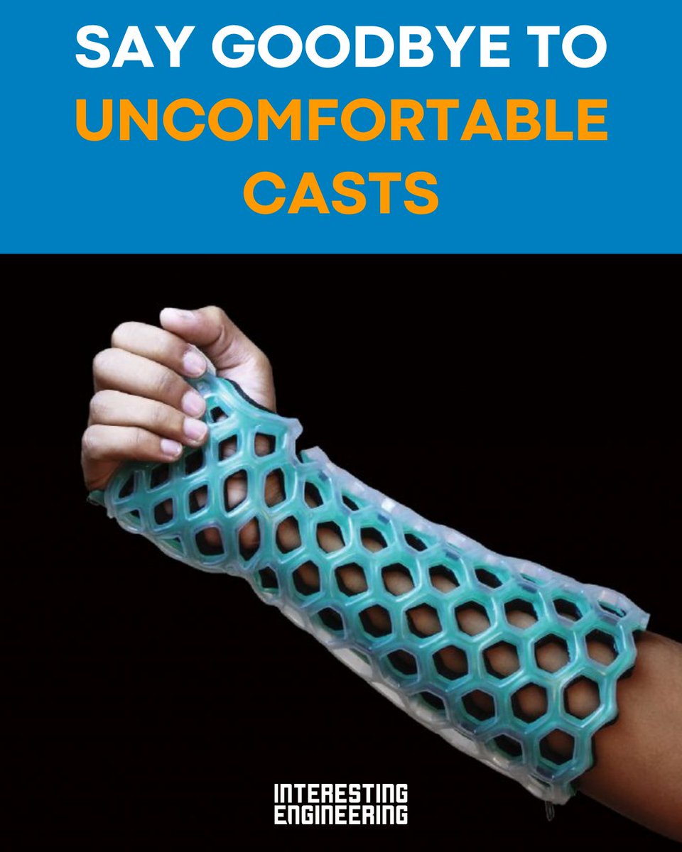 The primary purpose of this technology is to secure broken pieces in position while also promoting adequate airflow to the skin. Source Interesting Engineering