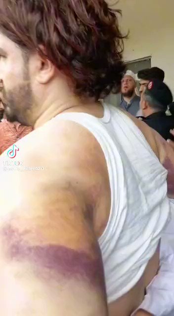 حکومت روزانہ فسطائیت کے نئے ریکارڈ قائم کرتے ہوئے - پشاور میں پولیس کا PTI کے ورکر پر تشدد کے واضح ثبوت #PakistanUnderFascism #PakistanUnderSiege