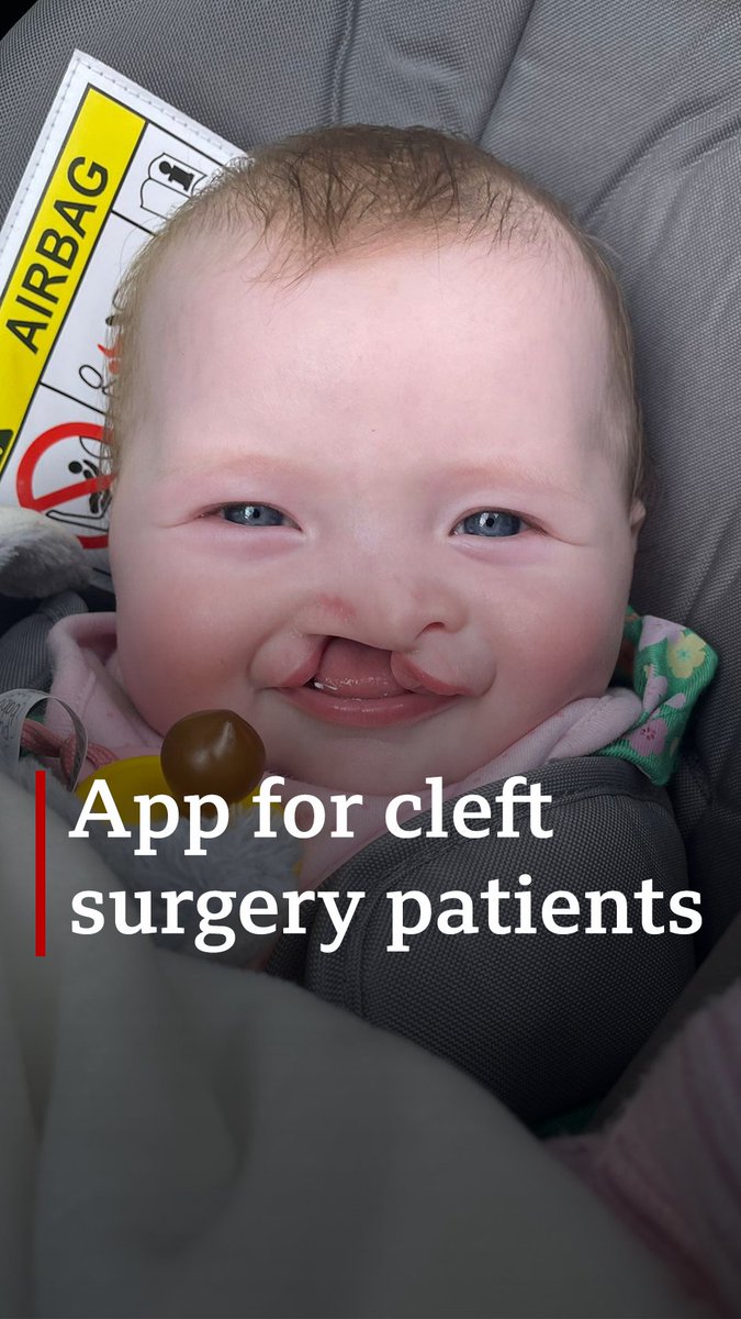 An augmented reality app is being trialled for families of children with a cleft lip and palate. The app uses 3D visuals to show parents what will happen to their baby during the procedure
