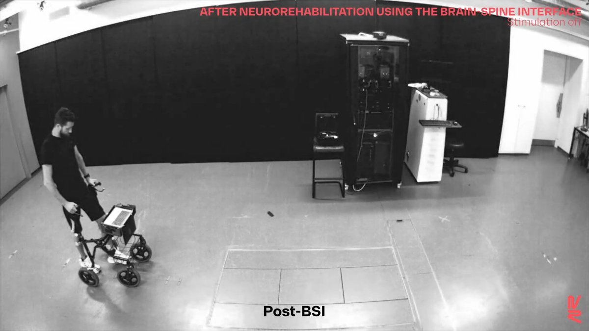 A nature paper demonstrates an implant that restores communication between the brain and spinal cord that helps a patient with paralysis of the arms and legs to stand and walk naturally.