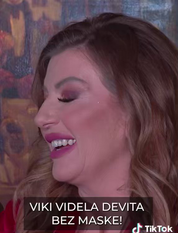 Imam jedno pitanje, što su joj desni ovako modre?