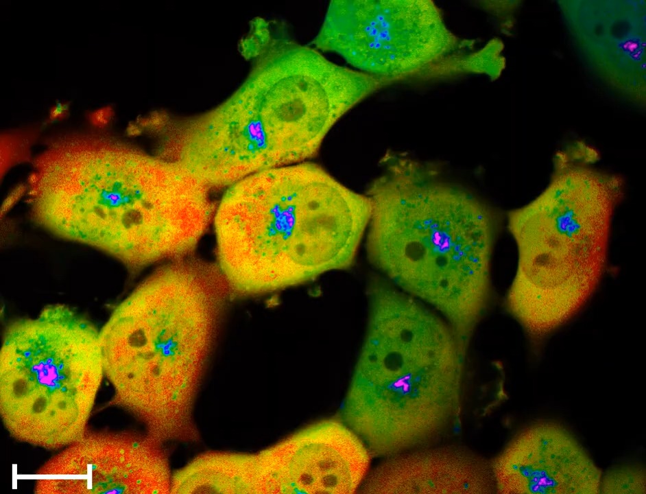 Notre Dame researchers have found that the single-cell pH of cancer cells changes dynamically during the four phases of cell division This discovery could eventually lead to therapies that will limit cancer cells’ ability to grow and divide: