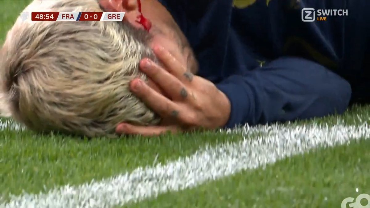 Oeiii.. 😬 Griezmann krijgt een schoen tegen z'n hoofd en het begint direct te bloeden 🫣 #ZiggoSport #Euro2024Qualifiers #FRAGRE