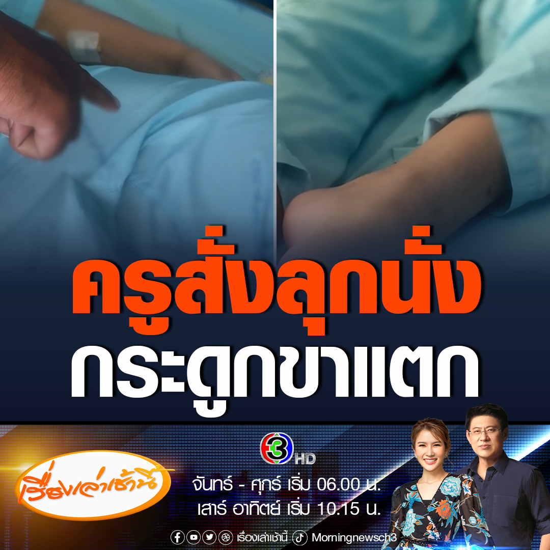 #เรื่องเล่าเช้านี้ พ่อสุดช้ำ! สงสารลูกชายชั้น ป.6 อายุ 12 ปี น้ำหนัก 80 กิโลกรัม บาดเจ็บกระดูกแตกร้าวและอักเสบที่ขาซ้าย หลังครูทำโทษสั่งลุกนั่ง 50 ครั้ง เหตุลืมแมสก์ คาบบ่ายเข้าเรียนช้าโดนสั่งลุกนั่งอีก 100 ครั้ง ต้องพักรักษาตัวต่อที่บ้าน ไม่ได้เรียนหนังสือจนถึงปัจจุบัน