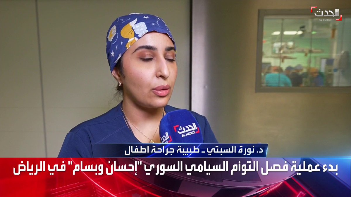 طبيبة جراحة الأطفال نورة السبتي لـ #الحدث عن عملية فصل التوأم السيامي السوري إحسان وبسام : نحن على مشارف المرحلة الأولى لإجراء العملية