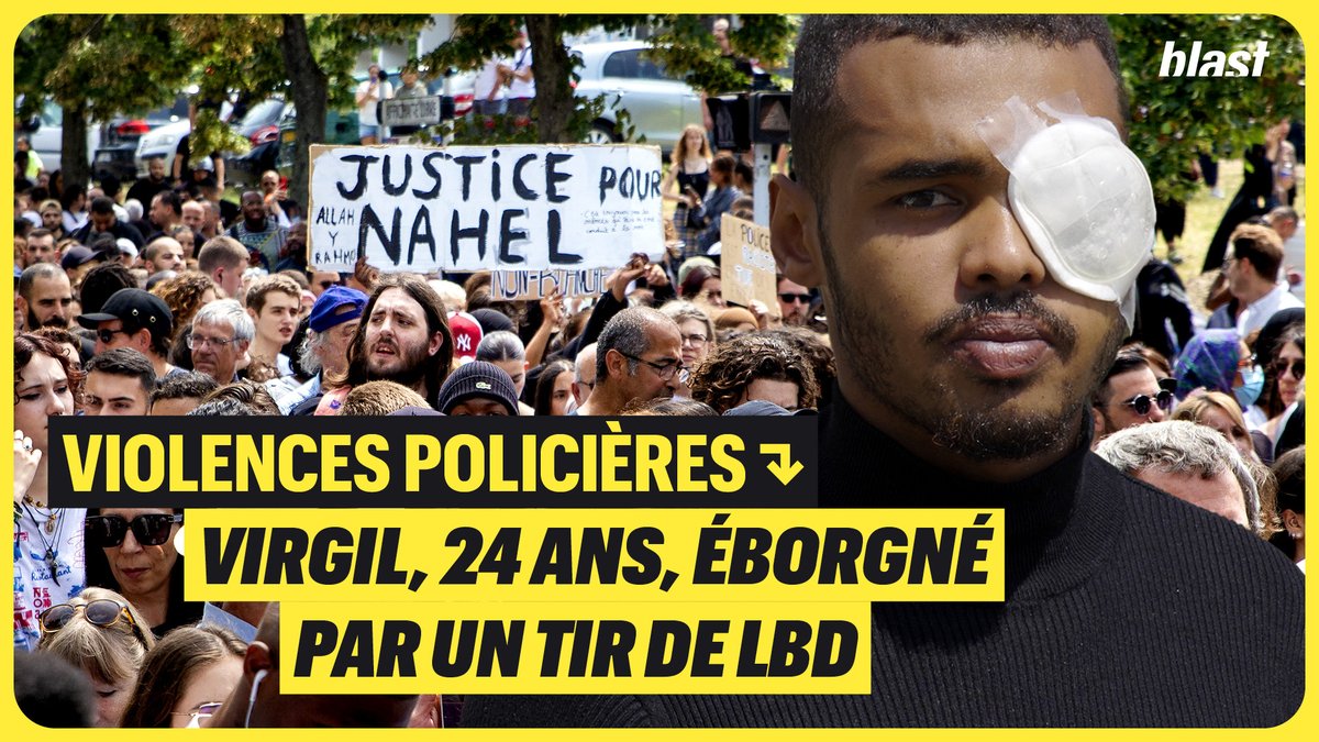🚨 Virgil, 24 ans ancien militaire, éborgné par un tir de LBD. Jeudi 29 après la marche pour Nahel. Il croise la route de policiers qui vont lui tirer dessus au LBD en visant la tête. Ce tir lui fera perdre son œil définitivement. BLAST, Le souffle de l'info