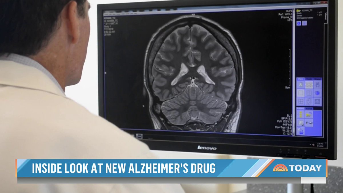 A promising, new Alzheimer’s drug just received full approval from the FDA. Maria Shriver takes a deeper look at how it slows cognitive decline and shares everything you need to know.