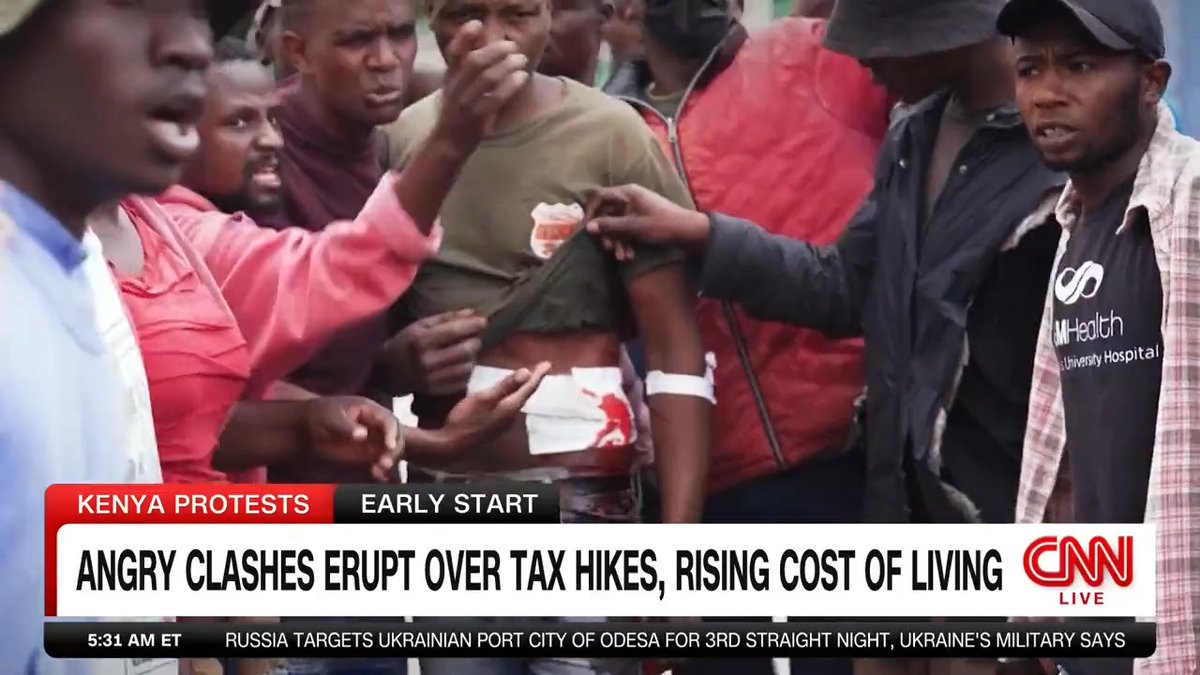 A construction worker near Kamukunji was hit by police. He was not in the demonstrations. I paid to take him to hospital. We saw police beat protesters. We saw people throw projectiles at cops. Our CNN report on the Kenyan opposition's #MaandamanoWednesdayToFriday