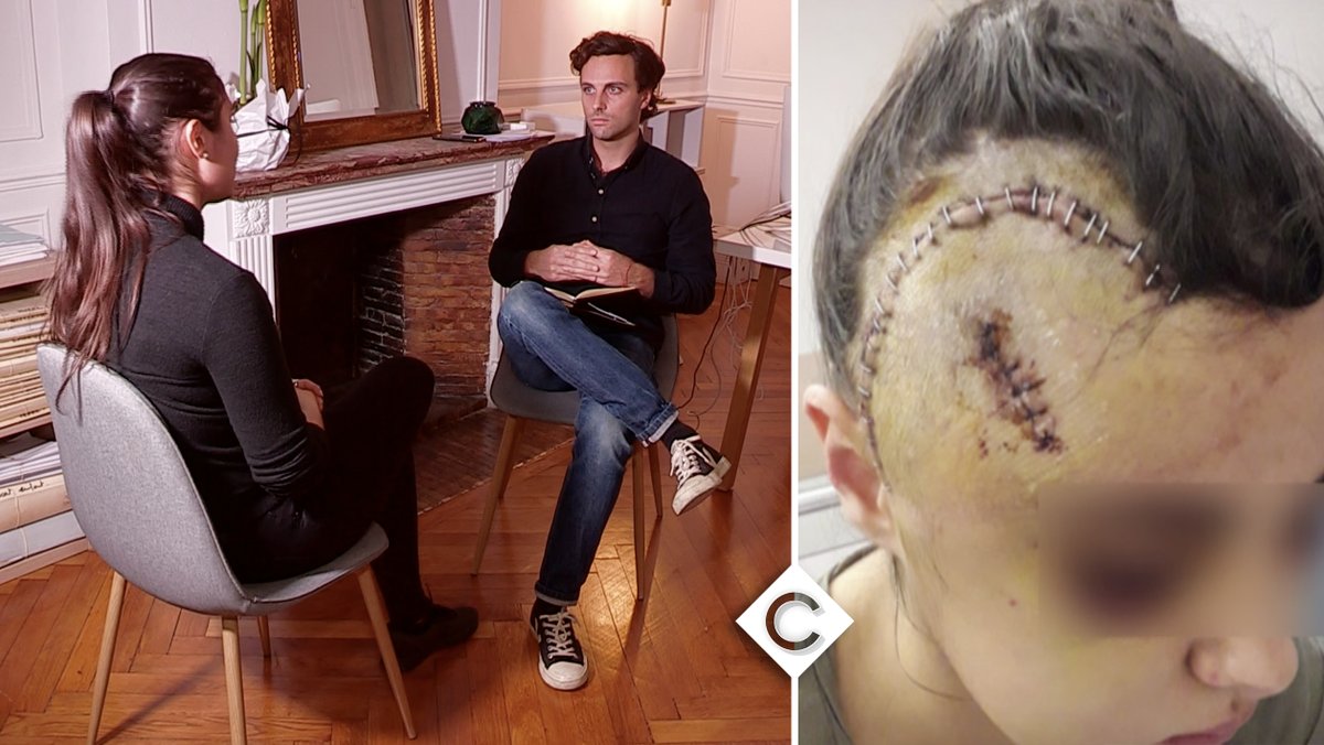 Affaire #Hedi : l’un des policiers déjà inquiété dans une enquête sur le tabassage d’une jeune fille, selon Mediapart. Les policiers lui avaient fracassé le crâne. Je l’avais rencontrée en 2020. Voici son témoignage.