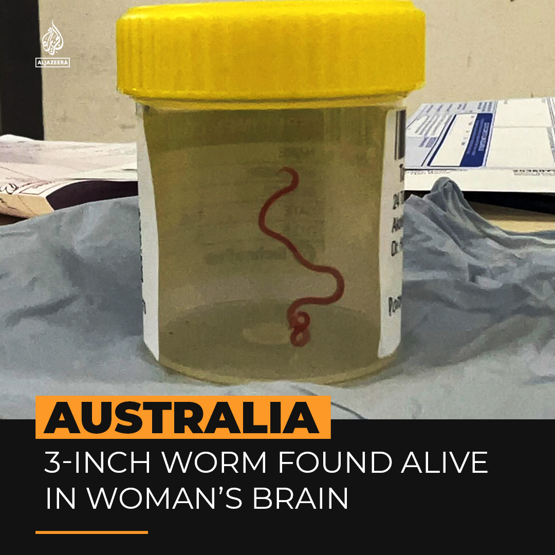 Doctors removed a 3-inch live worm from a woman’s brain in Australia last year. It’s believed to be the first-ever case of its kind and left doctors stunned ⤵️