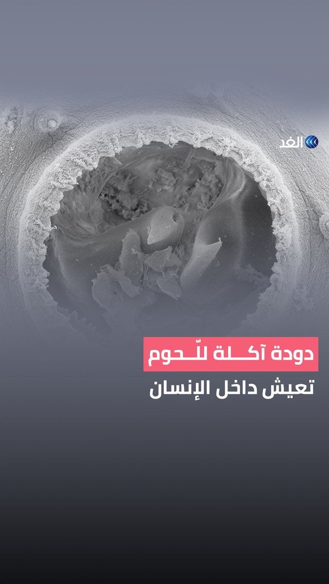 دودة آكلة للحوم البشر تقطن في أمعائهم.. كيف ذلك؟ .#قناة_الغد #AlGhadStory