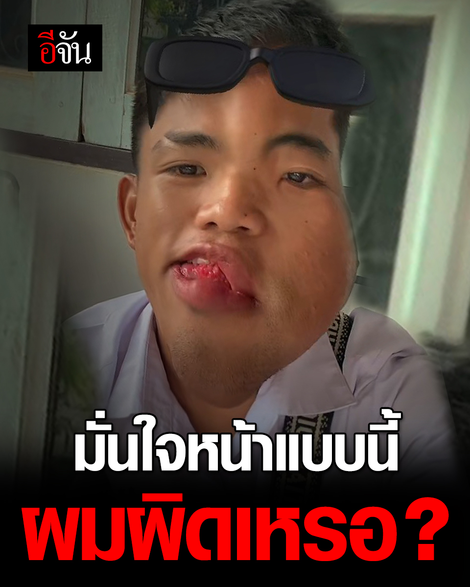 อยากให้ฟัง เสียงจากหัวใจ เด็กคนนี้ เกิดมาหน้าผิดรูป พอมั่นใจในตัวเอง กลับโดนบูลลี่อีก ทำไมบางคนใจร้าย กับน้องจังเลย!! #อีจัน