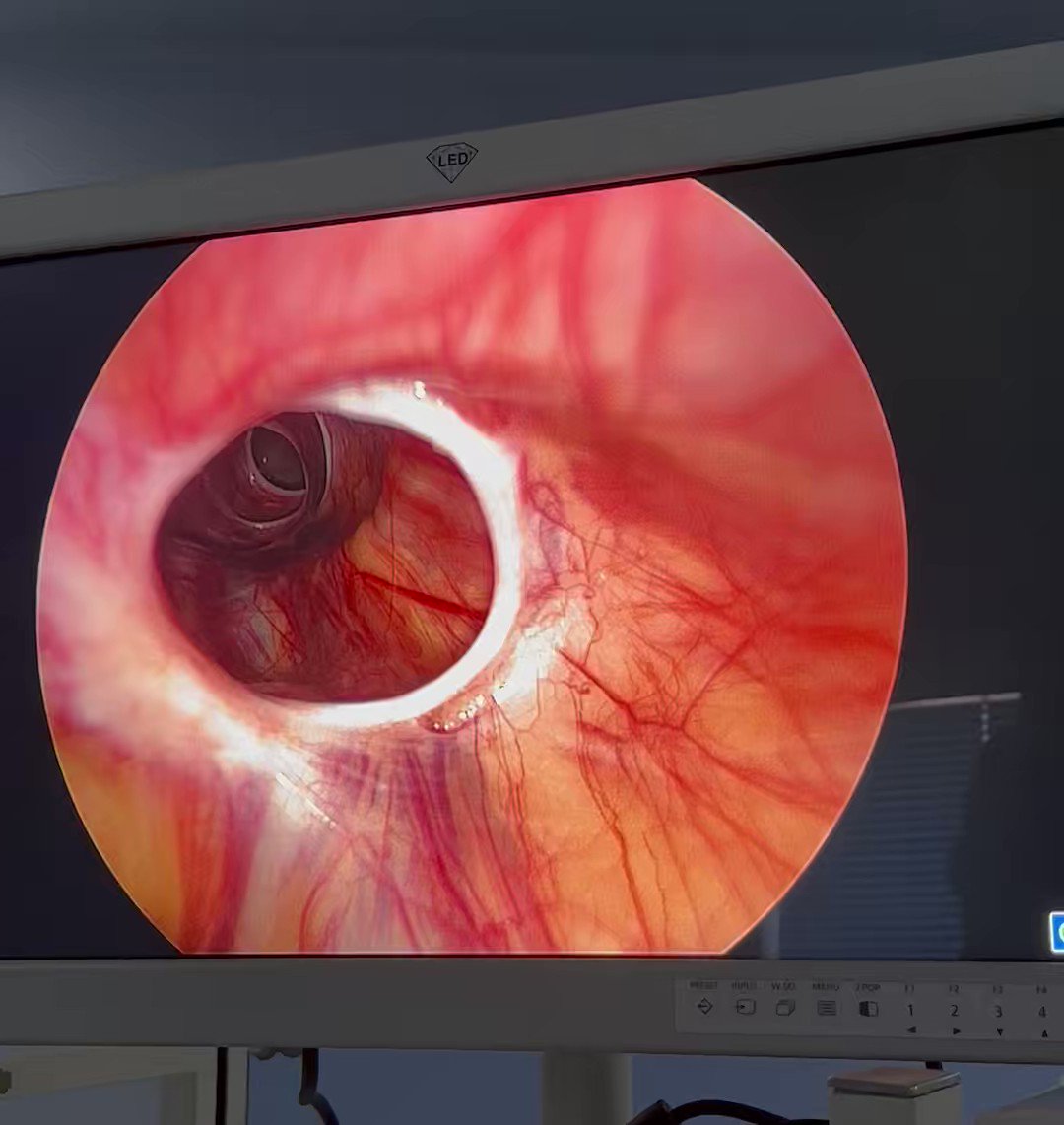Guess the location! 😊 #MedTwitter #SoMe4Surgery