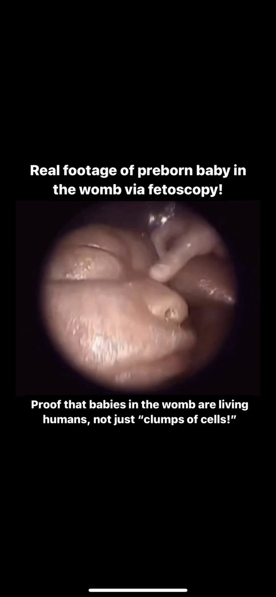 Babies in the womb are living humans, not just clump of cells!