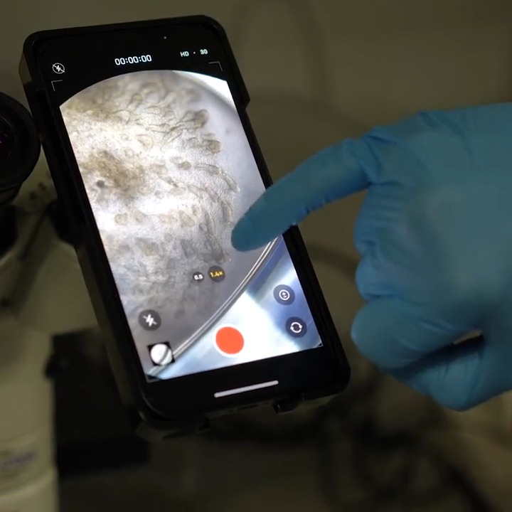 The Human Cell Atlas, a global effort to map and profile the body’s cells, will advance our understanding of the human body in ways not previously possible. How? Muzlifah Haniffa from the Wellcome Sanger Institute tells us more about this ambitious project we're proud to fund 📽️