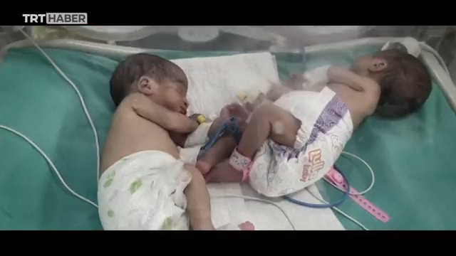Gazzeli bebekler için son saatler… Enerji bitmek üzere, temiz su yok, mama yok… Şifa Hastanesi yoğun bakım ünitesindeki bebekler için zaman daralıyor. Kaynaklar tükenirse tıbbi cihazlar duracak, bebekler hayatını kaybedecek... #LetGazaBabiesLive