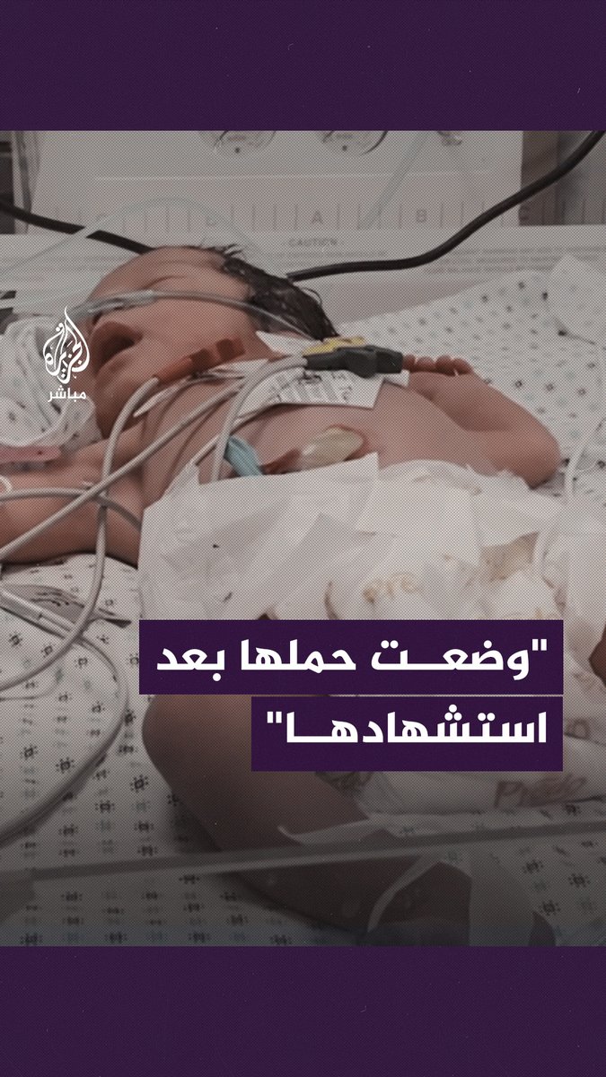 ولادة من رحم المـ ـوت.. طفل يُبصر الحياة بعد استـ ـشـ ـهاد والدته في قـ ـصـ ـف للاحتلال الإسرائيلي على #غزة #غزة_لحظة_بلحظة #الجزيرة_مباشر