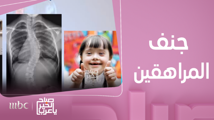 ماهو السبب وراء جنف المراهقين..وما هو علاجه #صباح_الخير_يا_عرب #MBC1 يعرض الآن مجاناً على شاهد بعد عرضه على الشاشة