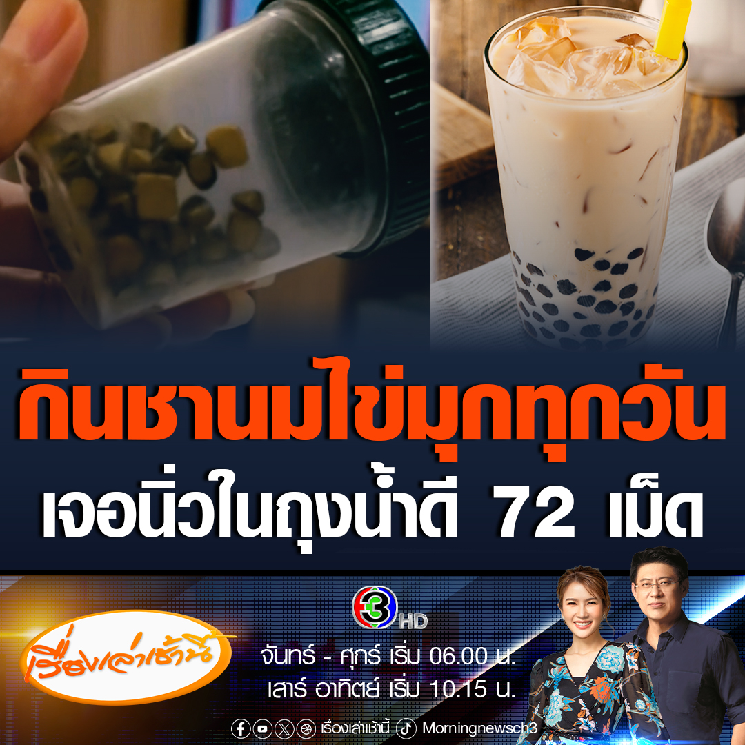 #เรื่องเล่าเช้านี้ สาวเล่าอุทาหรณ์ เจอนิ่วในถุงน้ำดีถึง 72 เม็ด เผยพฤติกรรมกินชานมไข่มุกวันละ 2-3 แก้ว มานานเป็นสิบปี ผ่าตัดนานมาก และหมดเงินไป 2 แสนกว่าบาท #ข่าวช่อง3 #ข่าวโซเชียล #ชานมไข่มุก #นิ่วในถุงน้ำดี