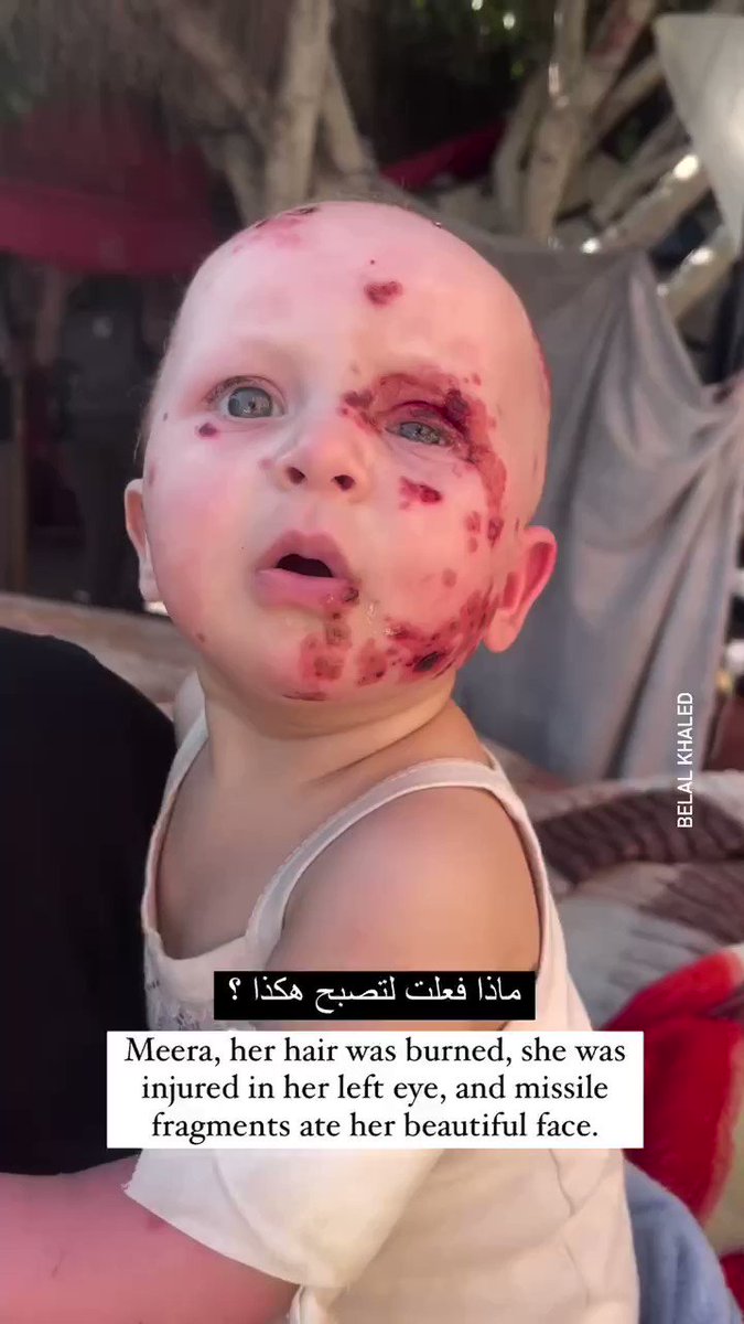 An eye on the atrocities | Gaza.