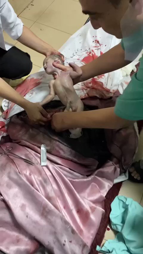Cebeliye’de insanlık dramı yaşanıyor İsrail, artık bebekleri anne karnında katlediyor Dünya bu katliamlara kör, sağır ve dilsiz #StopGenocide #Gaza #United4Palestine