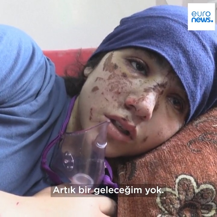 "Kendi bacaklarımı istiyorum. Protez bacaklar bana hep o anı hatırlatacak. Hatırlamak istemiyorum. Artık bir geleceğim yok" İsrail bombardımanı altındaki Gazze'de ampute edilen çocuklar ve yarım kalan hayalleri ▶️
