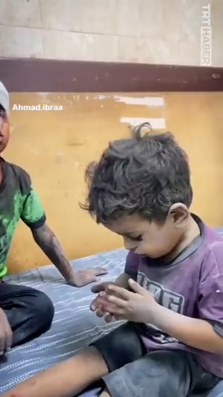 Bu minicik ellere kan bulaştıran İsrail... Korkudan titreyen Gazzeli çocuk, kendisi gibi yaralı ağabeyinden teselli bekledi.