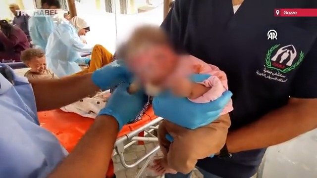 Hastane bahçesinde eli yüzü yanmış bir bebek, sedyede kanlar içinde bir çocuk… Bu minik bedenler İsrail’in saldırılarıyla yaralandı. El-Ehli Baptist Hastanesi’nin bahçesine sığınan yaralılar, kısıtlı imkanlara rağmen tedavi edilmeye çalışılıyor.