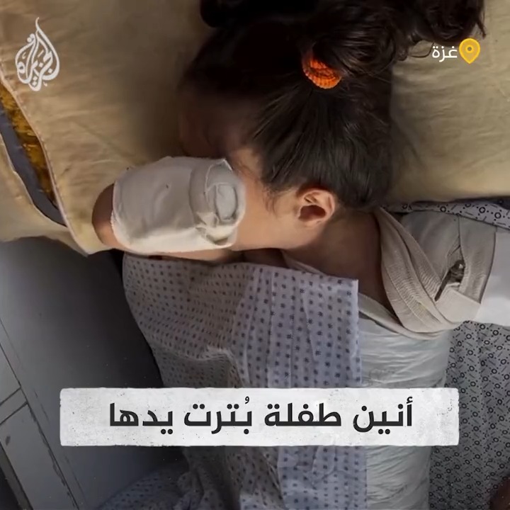 مشهد مؤثرة لأنين طفلة بُترت يدها بسبب القصف الإسرائيلي #حرب_غزة