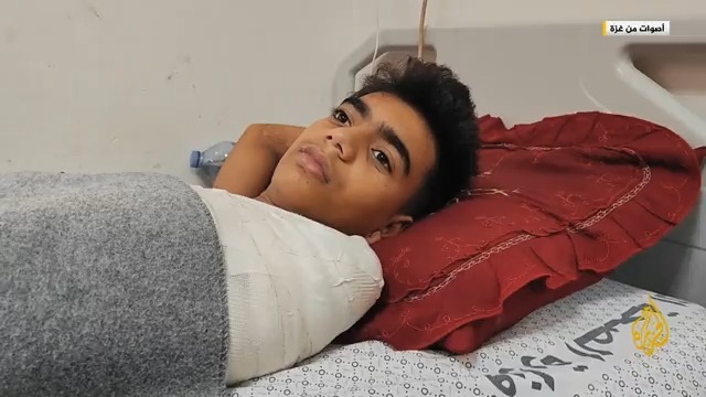 "حسيت ايدي تخدرت، ولما اجيت أمسكها ما لقيتها".. حالات نفسية وجسدية صعبة يعيشها أطفال فقدوا شيئا من أطرافهم بسبب القصف الإسرائيلي #حرب_غزة #الأخبار