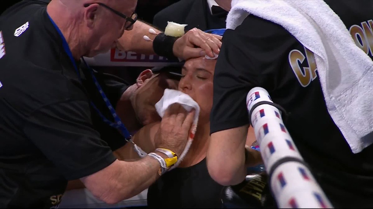 Work needed on the forehead of Cameron! Deep cut! 😲 #CameronTaylor2 | DAZN Boxing