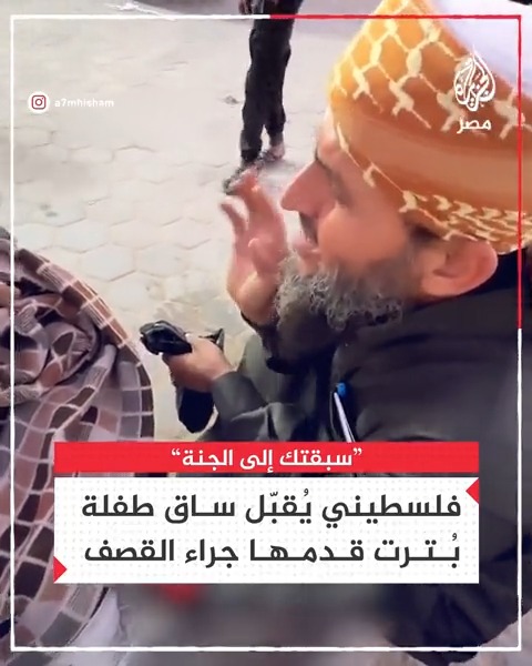 صاحب عبارة "روح الروح" يقبل ساق طفلة ويواسيها بعد بتر قدمها بسبب قصف الاحتلال