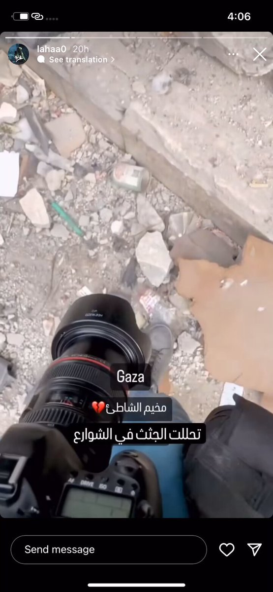 الي عم يشكك انه الصورة مفبركة هاد المقطع كامل بغض النظر ان كان الجثة فعلا متحللة او بسبب الحرق لكن المشهد قاسي والي بيصير كارثة