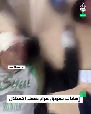 "حرقونا حرق".. مشاهد توثق تعرض فلسطيني ونجله لحروق شديدة جراء قصف الاحتلال لمنزله في مخيم النصيرات بقطاع غزة #حرب_غزة #فيديو