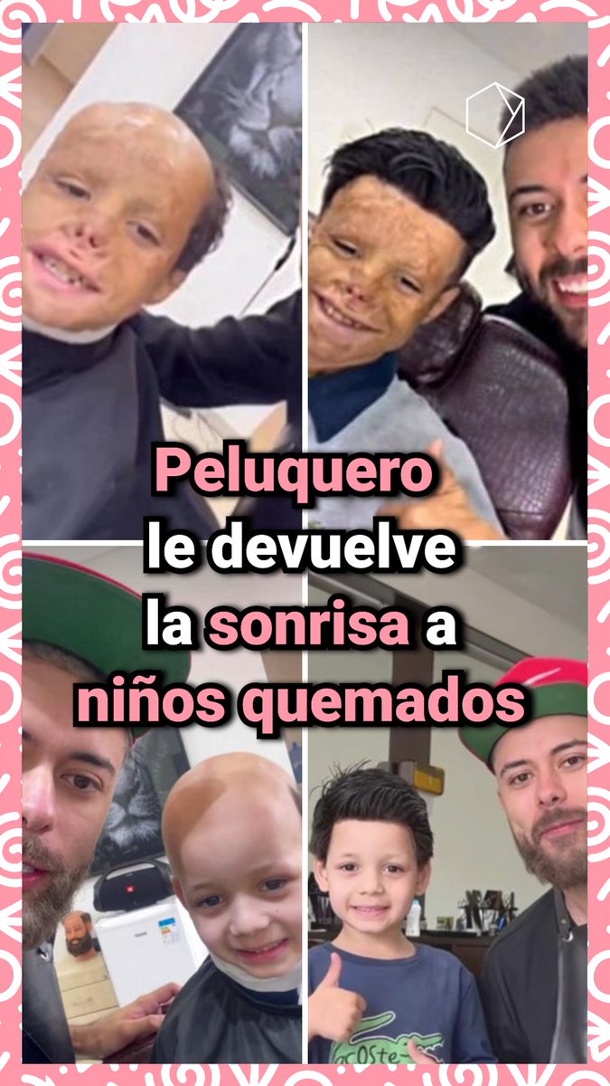 Gracias a Francisco Oliveira cada vez más niños recuperan su cabello y autoestima.🧒🏻✂️