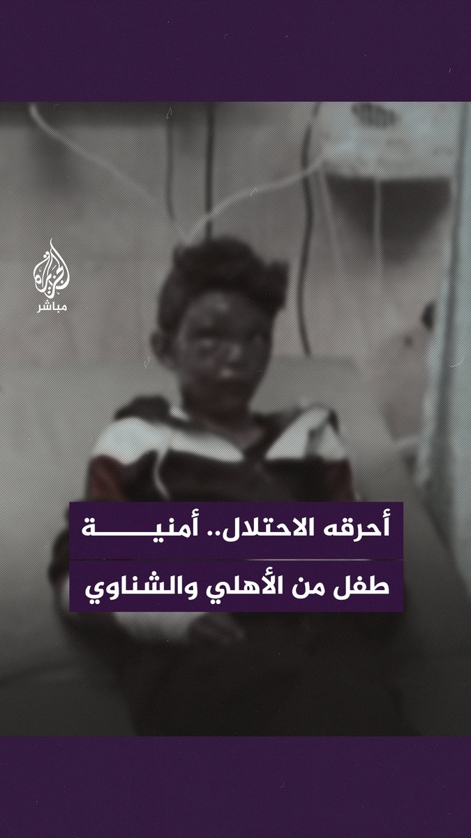 "كنت نفسي ألبس قفازات الشناوي وزِيّ الأهلي".. طفل مصاب في #غزة يوجه رسالة إلى النادي #الأهلي المصري #الجزيرة_مباشر | #فلسطين