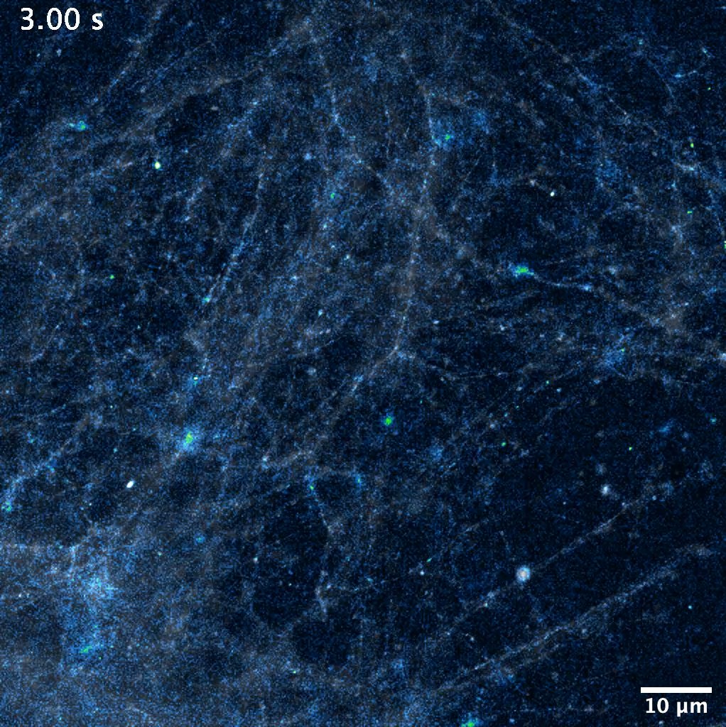 The fireworks in your mind. 🧠✨ This sparkling video shows the neurotransmitter glutamate being released into synapses, made possible by an indicator developed by Abhi Aggarwal, MD, Kaspar Podgorski, and team. #HappyNewYear #NYE