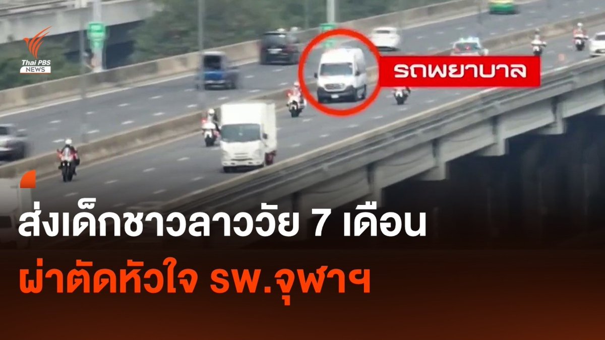 ภารกิจสำคัญของไทยและลาว ร่วมกันส่งเด็กชายชาวลาววัย 7 เดือน เข้าผ่าตัดหัวใจ เดินทางจาก จ.หนองคาย มา รพ.จุฬาลงกรณ์ ระยะกว่า 500 กม. ใช้เวลา 6 ชั่วโมง ด้วยความร่วมมือจากหลายฝ่าย #ลาว #ไทย #ผ่าตัดหัวใจ #โรงพยาบาล #ข่าววันนี้ #ข่าวไทยพีบีเอส #ข่าวที่คุณวางใจ #ThaiPBSnews #ThaiPBS