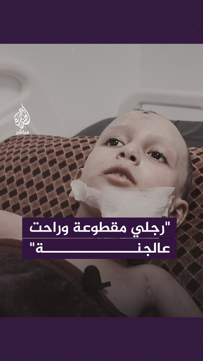“بدي أمشي”.. أحلام طفل فلسطيني بترت قدمه #الجزيرة_مباشر | #فلسطين